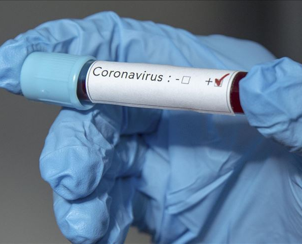 Coronavirus cases in the United States surpass the five-million mark