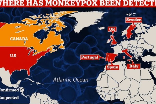 Monkeypox spreading to other countries after being detected in the United Kingdom