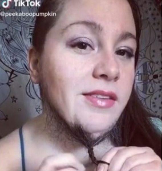 Bearded lady fed up with shaving embraces facial hair